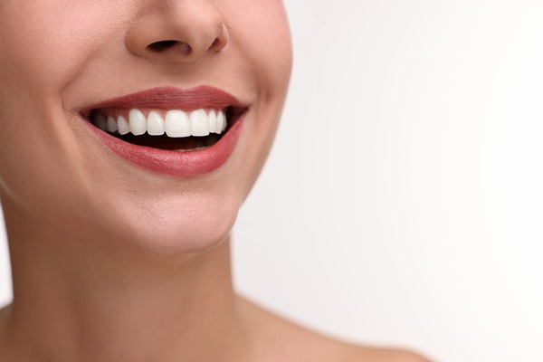 Reasons To Get A Smile Makeover